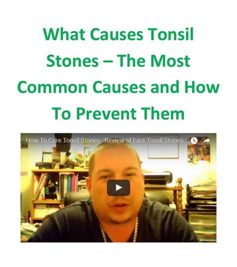 What Causes Tonsil Stones The Most Common Causes And How To Prevent T
