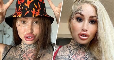 Model Mary Magdalene Can T Drink Through Straws Thanks To Multiple Surgeries