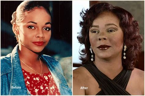 Top 10 Worst Celebrity Plastic Surgery Disasters from Hollywood --why