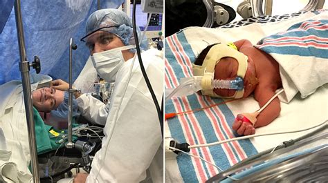 Mom Gives Birth In Cardiac Or Before Open Heart Surgery