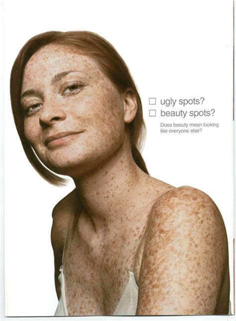 Freckles Fabulous A Campaign For Real Beauty Oh No She Didnt