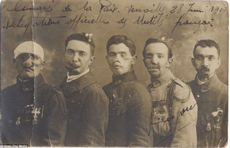 French Soldiers Display Their Reconstructed Faces Shaped By Dental