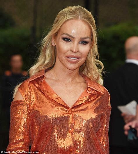 Katie Piper Reveals She Suffers From Depression And Anxiety A Decade