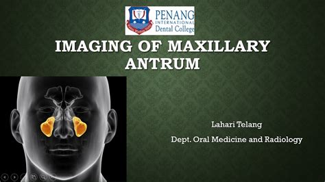 Imaging Of Maxillary Antrum Youtube