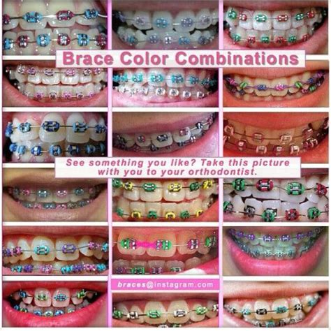 Color Combinations Cute Braces Colors Braces Colors Combinations Teeth Braces
