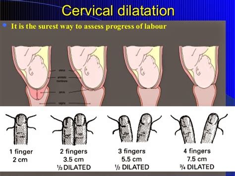 Checking The Cervix For Dilation How To Check A Cervix For Dilation