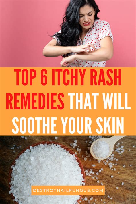 6 Best Itchy Rash Remedies You Can Try At Home Today