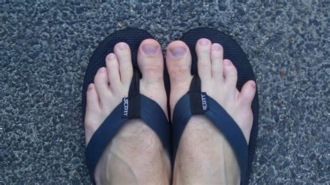 The answer to this question is the ability of an individual to walk with a broken big toe depends on the type of the fracture. Fracture Toe - Fracture Treatment