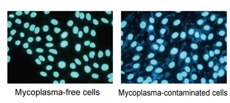 Mycoplasma Treatment Cell Culture Pregnancy Informations