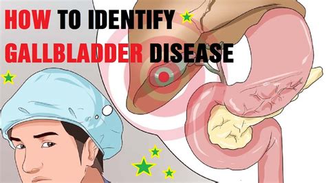 Howto Determine Gallbladder Disease | | Classic Urdu Material