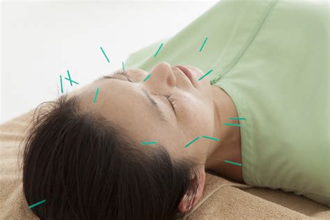 Facial Rejuvenation Or Cosmetic Acupuncture Pearl Acupuncture