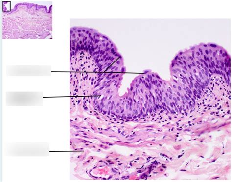 Urinary Bladder Histology Ii Diagram Quizlet