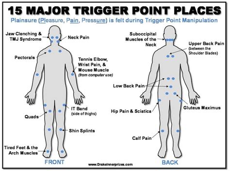 Plainsure How To Deal With Trigger Points Bear With Me Trigger Points Jaw Clenching