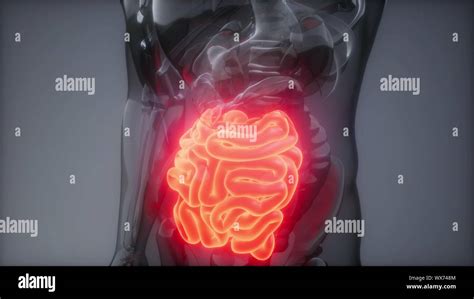 Human Small Intestine Radiology Exam Stock Photo Alamy