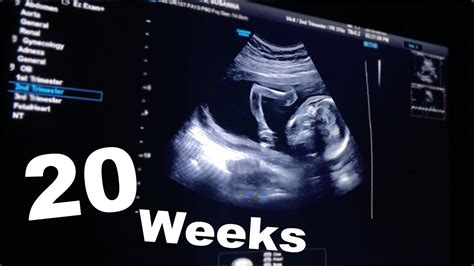 💖20 Weeks Pregnant Ultrasound Baby Sucking His Thumb💖 Youtube