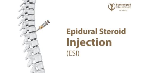 Epidural Steroid Injection Esi Thai Medics