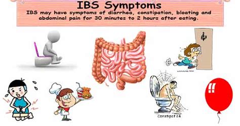 Irritable Bowel Syndrome Symptoms Ibs Symptoms