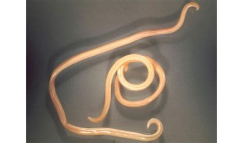 Roundworms In Humans