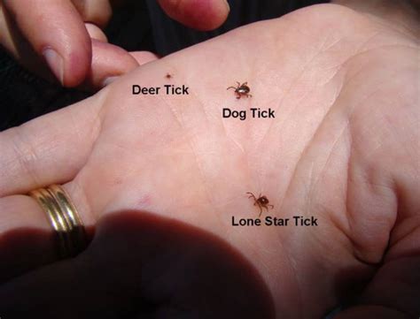 This Tick Makes You Allergic To Meat Heres What You Need To Know
