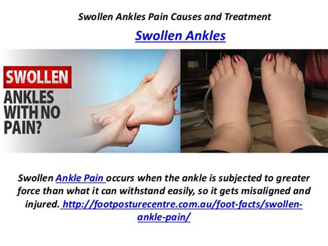 Swollen Ankles Pain Causes And Treatment