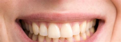 Healthy Teeth Are Not White Oxnard Gentle Dentistry