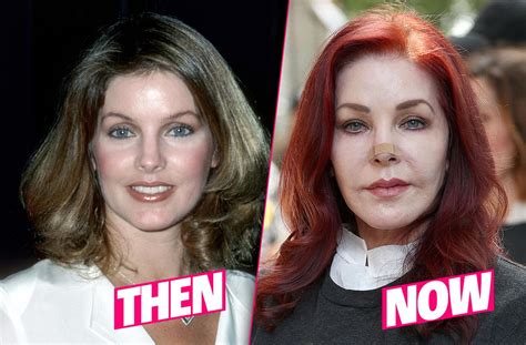 Discover more posts about priscilla presley. Priscilla Presley Ruins Looks After Skin Cancer Surgery Drama