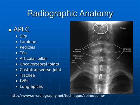 PPT - Cervical Spine PowerPoint Presentation - ID:732240
