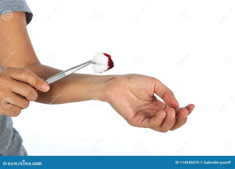 Doctor Cleaning Wound Area Of Injured Patient Stock Photo Image Of