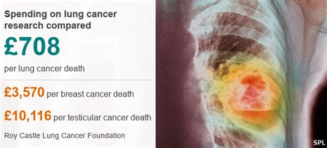 My Sister Died Of Lung Cancer But Never Smoked Bbc News