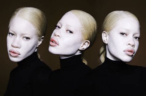 Diandra Forrest The Black Albino Supermodel Too Rare And Beautiful