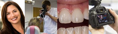Dental Photography In Practice
