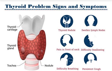 Thyroid Nodule Treatment What To Do Dr Gaurav Gangwani