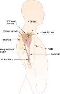 Give a slight push on the syringe to dispel a tiny amount of the vitamin b12 supplement to ensure the air is out of. 7.4 Intramuscular Injections - Clinical Procedures for ...