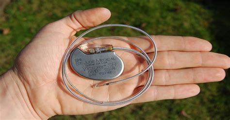 Normalise Heart Rate With Worlds Smallest Pacemaker Neopress