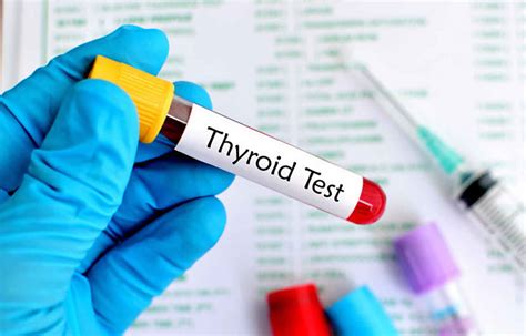 Thyroid Blood Test Thyroid Function Test Normal Values And Results