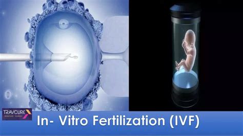 PPT In Vitro Fertilization IVF PowerPoint Presentation Free