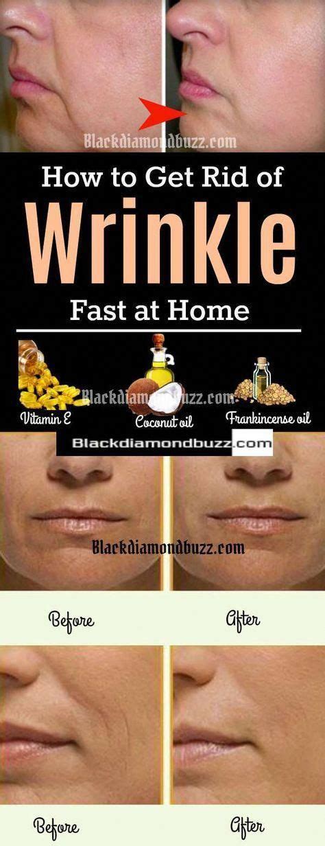 How To Get Rid Of Wrinkle Fast Wrinkles Begin To Appear On The Human