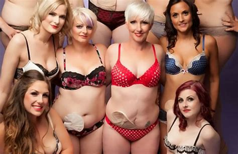 A Group Of Crohns Disease Sufferers Have Stripped Off For A Raunchy