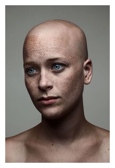 Pin By Arkadiusz Matyszewski On Face Refs Bald Heads Bald Women Balding