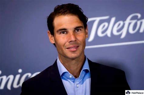 Rafael Nadal Hair Transplant Story Success Or Failure