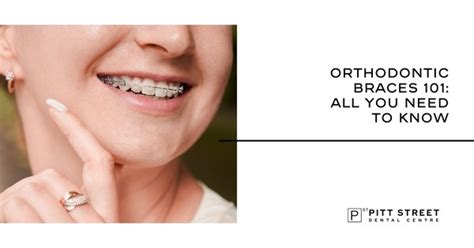 Orthodontic Braces 101 All You Need To Know Pitt Street Dental Centre