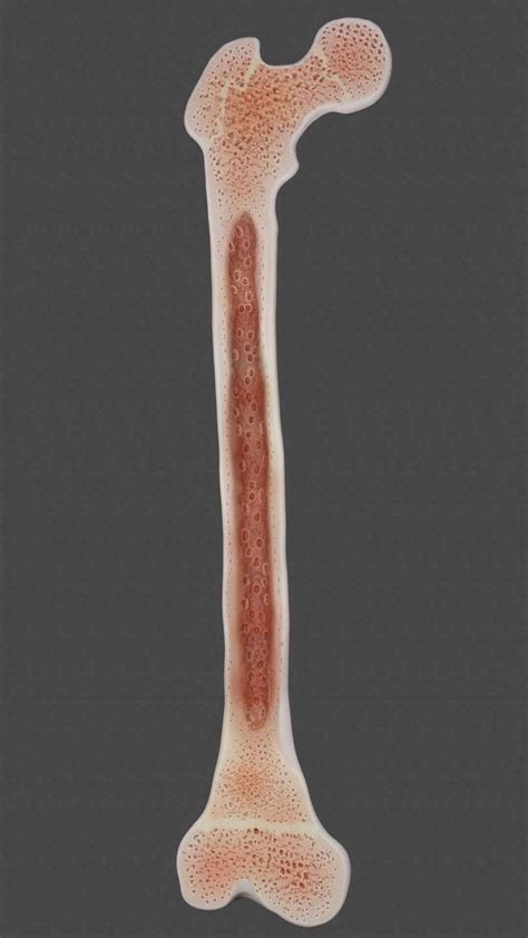 Femur Bone Closed And Sliced 3D Model By OtavioOliveira