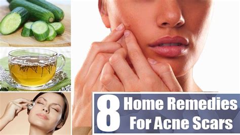 05 Most Effective Ways To Remove Acne Scars And Pimple Marks Deep Scars