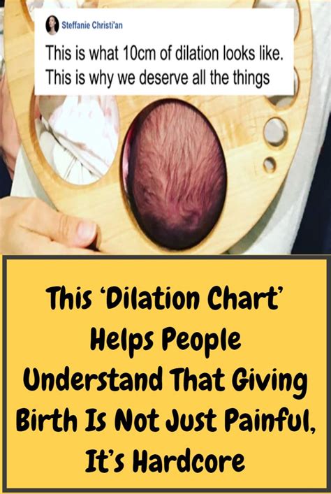 This ‘dilation Chart’ Helps People Understand That Giving Birth Is Not Just Painful It’s
