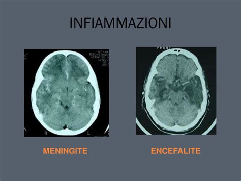 PPT - SCIENZE TECNICHE APPLICATE Tomografia Computerizzata ...