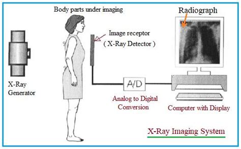Xrays Definition Block Diagram And Working Of Xray