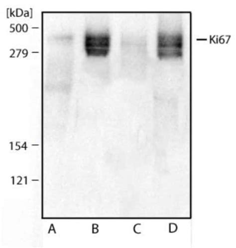 Anti Ki 67mki67 Polyclonal Novus Biologicals 01mg Unlabeledlife