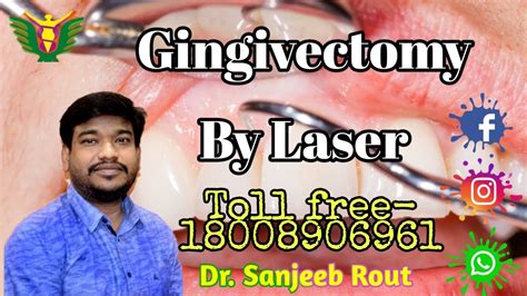 Gingivectomy By Laser Dr Sanjeeb Rout Balaji Skin And Hair Contact