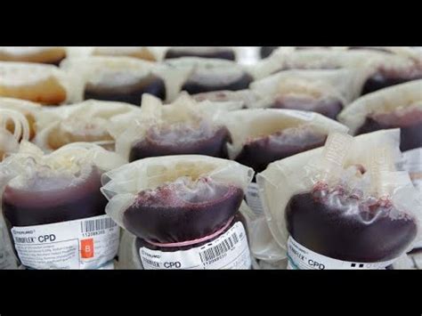 Syarat penerima pkh harus mempunyai minimal 1 dari ketiga komponen yang ada di pkh. Penderma darah aset negara - Dr Adham - YouTube