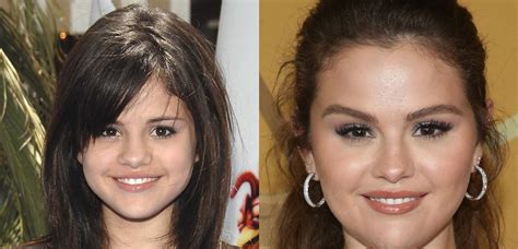 Why Some Fans Think Selena Gomez Got Plastic Surgery